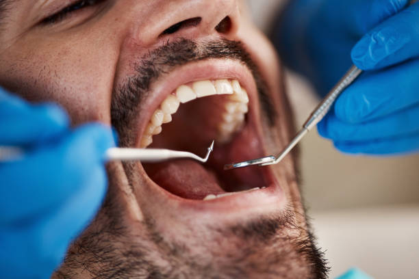 Best Emergency Denture Repair in Tangent, OR